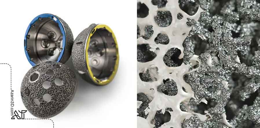 چه شرکتهایی ایمپلنتهای سهبعدی تولید میکنند چه شرکتهایی ایمپلنتهای سهبعدی تولید میکنند