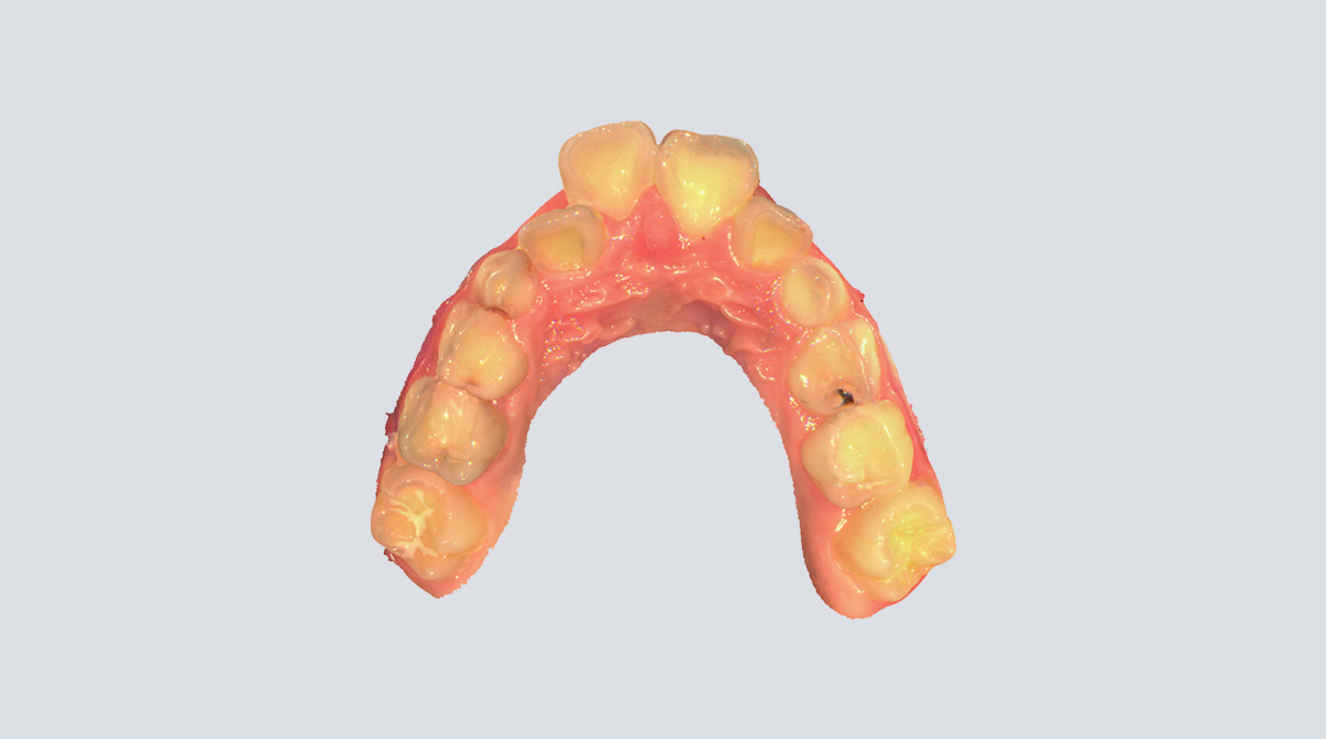 اسکنر داخل دهان شاینینگ Shining 3D Aoralscan 3 Intraoral Scanner | Aoralscan-3