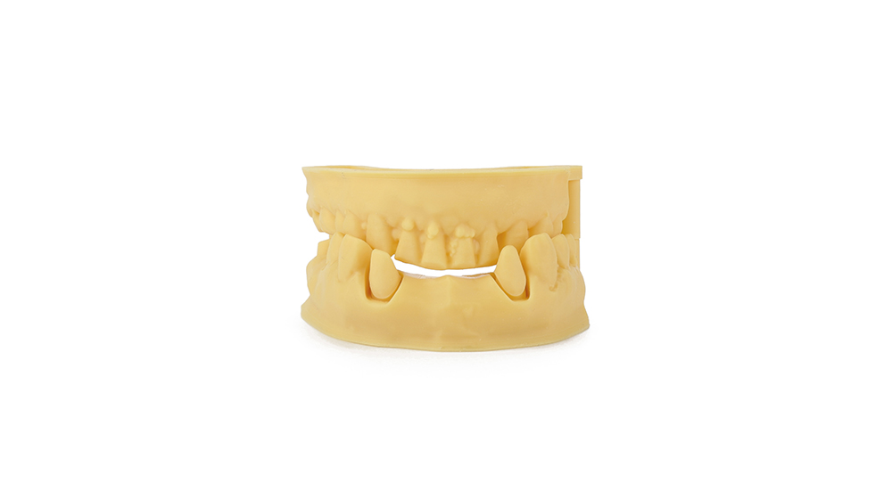 رزین مدلسازی دندان